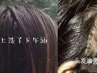 周柯宇揭秘：李雾头皮一松幕后真相，竟是自我发挥之作